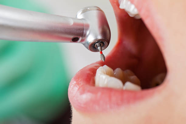 Best Emergency Treatment for Toothache in Flandreau, SD